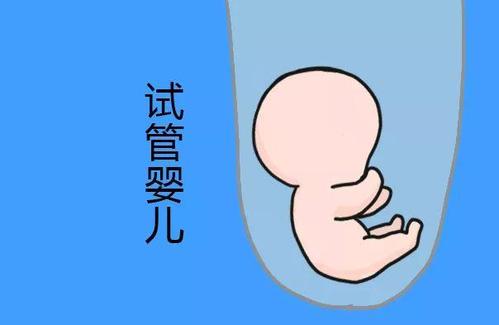 培养箱
